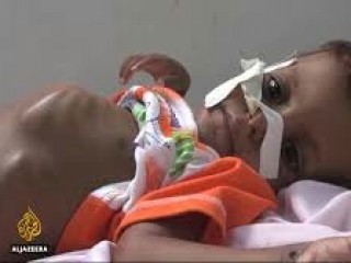 ޔަމަނުގައި އެކަށީގެންވާ ވަރަށް ކާނާ ނުލިބޭ މީހުން އަދަދު ހަތް މަސް ތެރޭގައި ތިން މިލިއަނަށް އިތުރުވެއްޖެ: އދ.