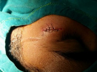 Customer hits expat worker after having to wait 'too long for his food'