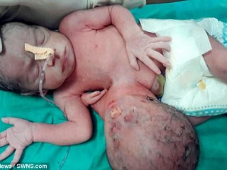 ބަނޑުން އިތުރު ބޮލެއް ފަޅާފައިވާ ކުއްޖަކު އުފަން ވެއްޖެ