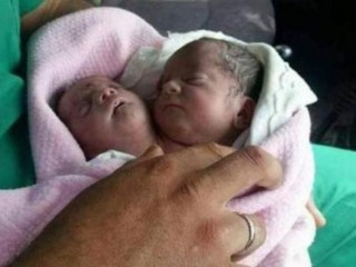 ދެ ބޯ ހުރި ކުއްޖަކު ސީރިއާގައި އުފަން ވެއްޖެ