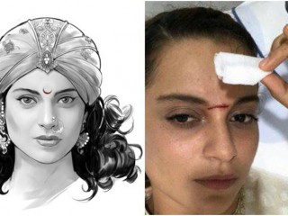 ކަނޑިއަކުން ޖެހި ކަންގަނާ ޒަޚަމްވެއްޖެ