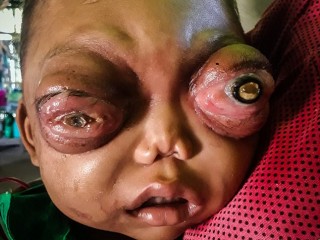 ޖެހިފައިވާ ބައްޔެއްގެ ސަބަބުން އިންޑިއާގެ ކުއްޖެއްގެ ލޯ ބޭރަށް ނުކުންނަނީ 