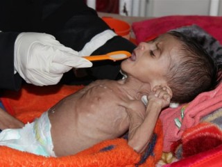 އެހީ ނުލިބިއްޖެ ނަމަ އަންނަ ހަފްތާގައި ވެސް އެތައް ސަތޭކަ ބަޔަކު މަރުވާނެ: ޔަމަނުގެ އެހީދޭ ޖަމާޢާތްތައް