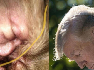 ކުއްތާއެއްގެ ކަންފަތް ތެރޭގައި ޑޮނަލްޑް ޓްރަމްޕް!