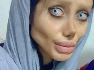 މީހަކު އެންޖެލީނާ ޖޯލީއަށްވާން 50 އޮޕަރޭޝަން ކޮށްފި