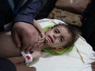 ސީރިޔާ ހަނގުރާމަ: ސީރިއަސް ހާލަތުގައިވާ 100 އަށް ވުރެ ގިނަ ކުދިން ފަރުވާދިނުމަށް ގެންގޮސްދިނުމަށް ޔުނިސެފުން އެދެފި