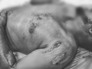 Doctors say that he has sustained several external injuries