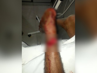 ކަތިވަޅިން ހަމަލާދީ ޒަހަމްކޮށްލާފައިވާ ޒުވާނާގެ ފައި