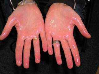 އަތްފައި ދާ ހިތްލާތަ؟ ކަންބޮޑު ނުވޭ މި އޮތީ ހައްލު!