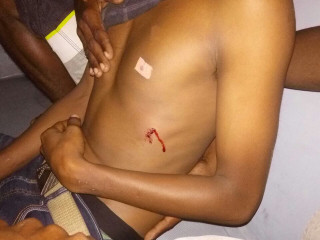 ޒުވާނެއްގެ މެޔަށް ތޮޅިއެއް ހެރި ކުޅުދުއްފުށީ ރީޖަނަލް ހޮސްޕިޓަލުގައި ފަރުވާ ދޭން ފަށައިފި