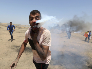 ޓިއަރ ގޭސް ކެނިސްޓަރ ވަދެގެން ދިޔައީ މޫނަށް، އަނގައިންނާއި ނޭފަތުން އަރަމުން ދިޔައީ އޮލަ ދުން!