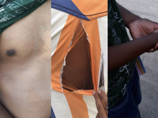 އެސްއޯ ފުލުހުންތަކެއް އާންމުންނަށް ދިން ކަމަށް ބުނާ އަނިޔާ ފެންނަ ބައެއް ފޮޓޯތައް