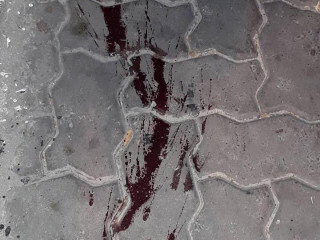 އެމްއެމްއޭ ކައިރިން ޒުވާނެއްގެ ކަރަށް ވަޅި ހަރައި، މަރާލައިފި