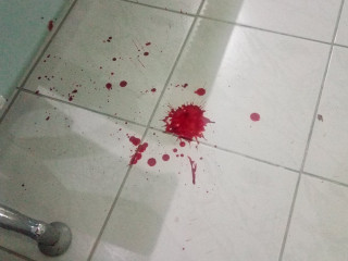 ދުވާފަރުގައި ތޫނު އެއްޗަކުން ހަމަލާދިން ޒުވާނާއަށް އައިޖީއެމްއެޗްގައި ފުރަވާ ދެނީ