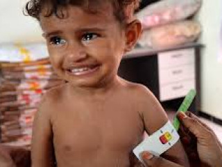 ހުދައިދާގެ ހިފުމަށްކުރާ ހަނގުރާމައިގެ ސަބަބުން ހޮސްޕިޓަލްގައި ތިބި 59 ކުއްޖެއްގެ ފުރާނަ ނުރައްކަލުގައި