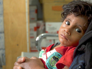 ޔަމަންގައި ހިނގަމުންދާ ދާހިލީ ހަނގުރާމަގައި 85000 ކުޑަކުދިން މަރުވެފައިވޭ : ރިޕޯޓް