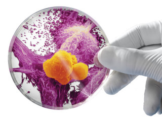 ކެންސަރަށް ފަރުވާއެކޭ ބުނެ އޮޅުވާލައިގެން ބޭސް ވިއްކި މީހަކު ޖަލަށް