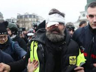 ލިބުނު ޒަޚަމްތަކަށް ފަހު ރޮޑްރިގޭޒް އޮތީ އާޓިފިޝަލް ކޯމާއެއްގައި