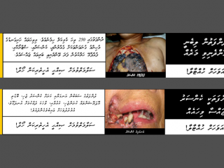 ދުންފަތުގެެ ބާވަތްތަކުގައި ބޭނުންކުރުމަށް ހަމަޖެހިފައިވާ ލޭބަލް