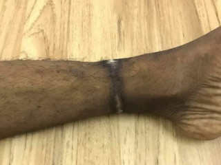 ނިޔާވި މީހާގެ ފައިގައި ހުރީ އާއިލާއިން ޗޭނު ޖެހި ނިޝާން: ޖެންޑަރ