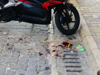 އެކްސިޑެންޓް ހިނގި ސަރަހައްދު