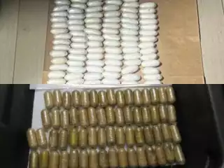 ކުނިވެފައި އޮތުމުގެ ސަބަބުން، ހޮސްޕިޓަލަށް ނުގެންގޮސް ފެޅި ކަމަށް ބުނި ހަށިގަނޑު، ސީޓީ ސްކޭން ހެއްދީ ހޮސްޕިޓަލު ގައި! 