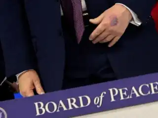 އެމެރިކާގެ ރައީސް ޓްރަމްޕްގެ އަތްޕުޅުގައި ނޫފައިގެންފައި ހުރި ނިޝާންތަކެއް ފެނުމާ ގުޅިގެން އެއީ މޭޒެއްގައި އަތްޕުޅު ޖެހިގެން ދިމާވި ކަމެއް ކަމަށް އޭނާ ވިދާޅުވެއްޖެ