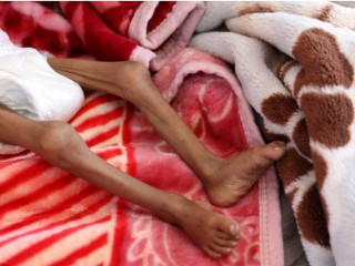 ރަނގަޅު ކާނާ ނުލިބުމުގެ ސަބަބުން ކުޑަކުއްޖަކަށް ހޮސްޕިޓަލްގައި ފަރުވާދެނީ