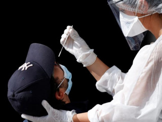 ފްރާންސްގެ ސިއްހީ މަސައްކަތްތެރިއަކު ކޮވިޑް-19 އަށް މީހަކު ޓެސްޓް ކުރުމަށް ސާމްޕަލް ނަގަނީ