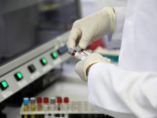 Sample collected by healthcare officials, for Covid-19 testing