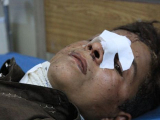 އަފްގާން ސަރުކާރުންނާ ސަރުކާރައް ބާރުދޭ ފަރާތްތަކުން ދިން ހަމަލާތަކުގައި އަހަރުގެ މިހާތަނަށް އާންމުންގެ 717 މީހުންވަނީ މަރުވެފައެވެ.