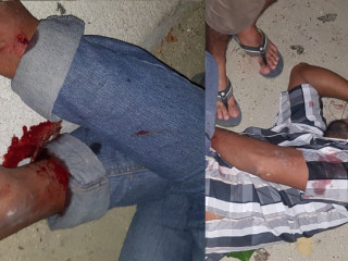 ކ. ދިއްފުށީގައި ހިނގި ހަމަނުޖެހުމެއްގައި މީހަކު ޒަހަމްކޮށްލާފައި: ހަމަނުޖެހުން ފެށުނީ ރަށުގައި ވައްކަން އާންމުވުމުން