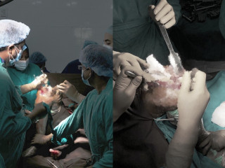 ޑރ. އަބްދުއްސަމަދު މެމޯރިއަލް ހޮސްޕިޓަލުން ކުރިއަށްގެންދިޔަ ކަކުލު ހުޅުގެ އޮޕަރޭޝަންގެ ތެރެއިން