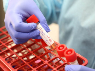 Maldives continues to see gradual decline in new Covid-19 infections