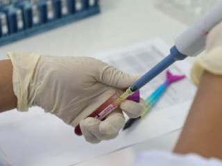 ކޮވިޑްގެ ސާމްޕަލްއެއް އައިޖީއެމްއެޗްގެ ލެބުގައި