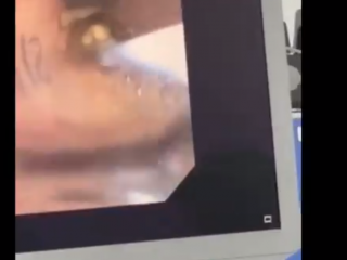 ކުޑަކުއްޖެއްގެ ފުއްޕާމެއިން ކެޝޫނަޓެއް ނެގުން