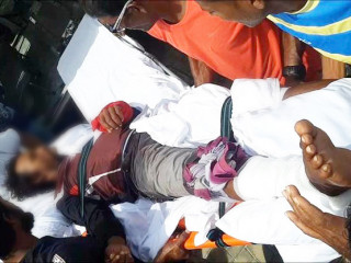 7 ފޫޓުގެ މިޔަރެއްގެ ޝިކާރައަށްވީ ދޮށީގައި ކުއްލިއަކަށް ކަންނެއްޔެއް ގަތުމުން، ކޯސްޓްގާރޑަށް ޚާއްސަ ޝުކުރެއް