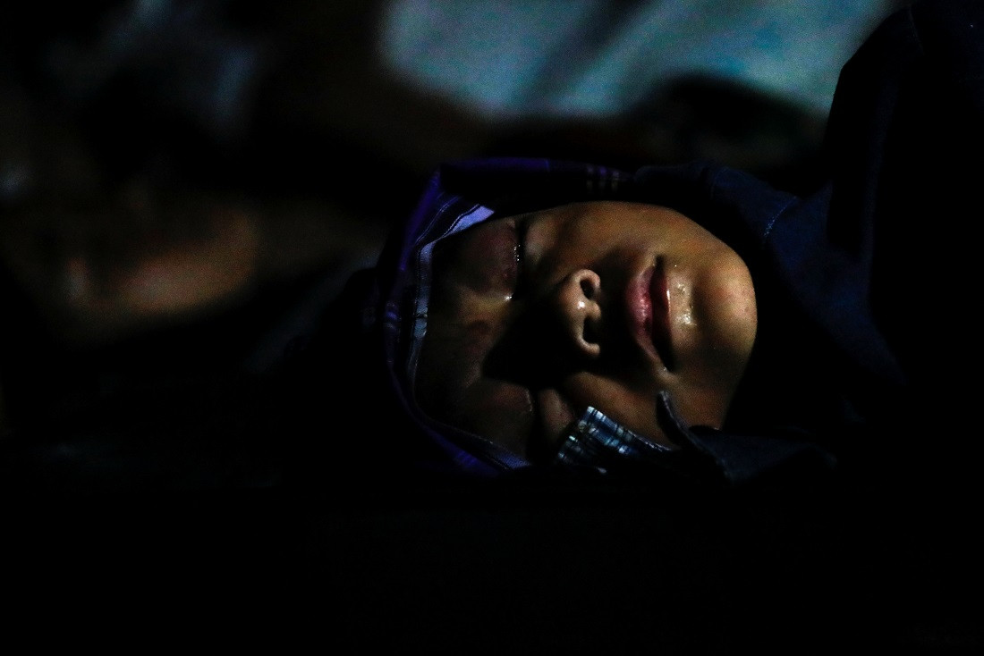 އިންޑޮނޭޝިއާގެ ވެސްޓް ޖާވާ ޕްރޮވިންސްގެ ސިއަންޖޫރުގައި ހުންނަ ސިއަންޖޫރީ ރީޖަނަލް ހޮސްޕިޓަލުގައި ޒަހަމްވި މީހަކަށް ފަރުވާ ދެނީ. ފޮޓޯ - ރޮއިޓާސް