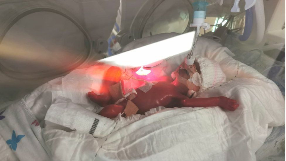 ސޯފިއާއަށް ހޮސްޕިޓަލްގައި ފަރުވާ ދެނީ