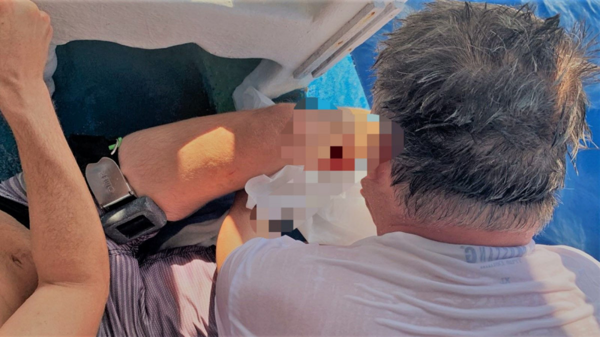 ފިލިތެޔޮ އައިލޭންޑް ރިސޯޓުގެ ޑައިވިންގ ޓީޗަރަކަށް މިޔަރެއް ހަމަލާ ދިނުން