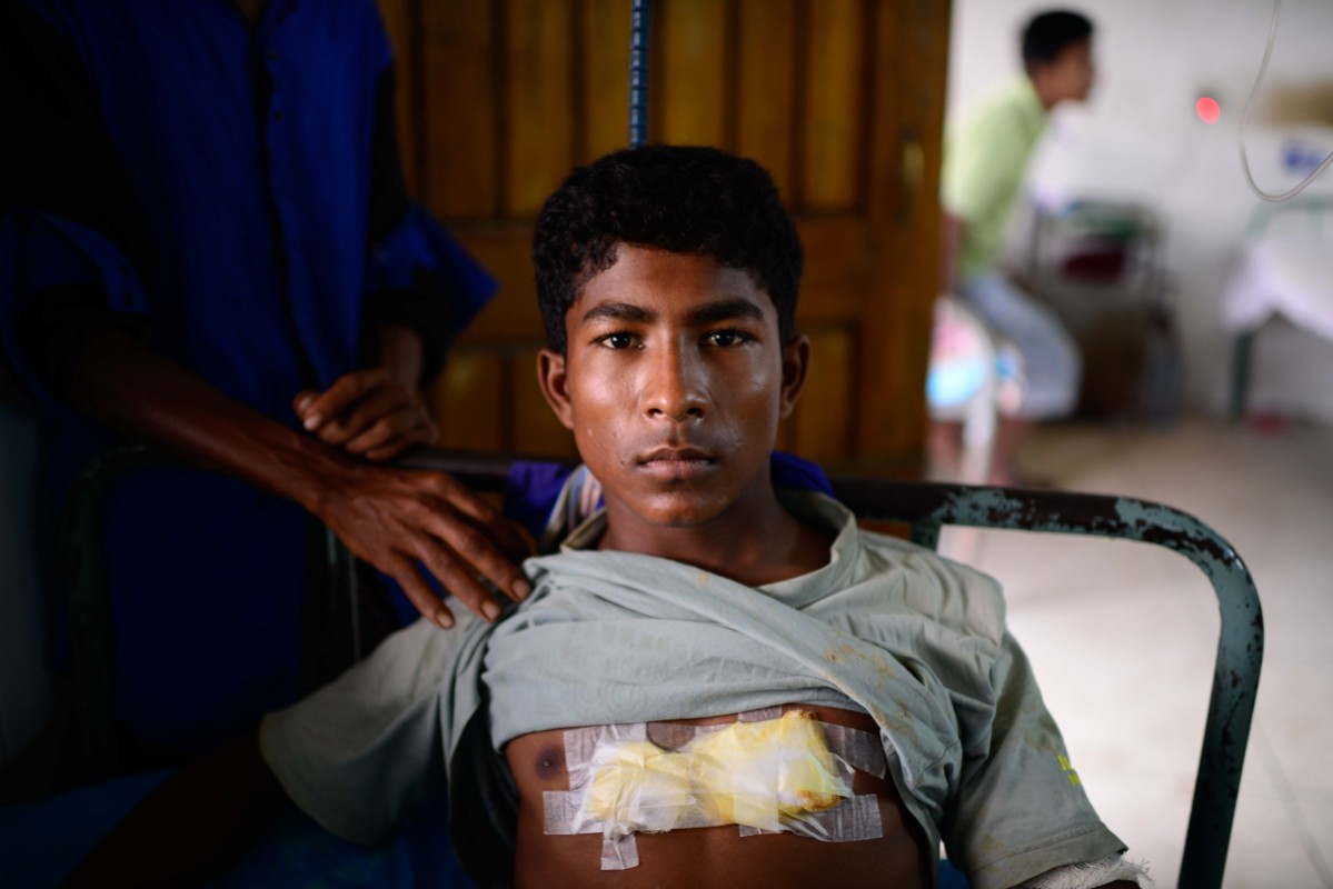 ސެޕްޓެމްބަރު 10، 2017:ރޮހިންޖާގެ މުސްލިމަކު މިއަންމާގެ ސަލާމަތީ ބާރުތަކުން އަނިޔާކުރުމާއި ގުޅިގެން ހޮސްޕިޓަލްއިން ފަރުވާ ހޯދަނީ، މިއަންމާގެ ސަލާމަތީ ބާރުތަކުން ވަނީ މިހާތަނަށް 400 އަށްވުރެން ގިނަ މީހުން ވަނީ މަރާފައި