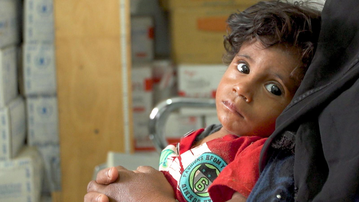 ޔަމަނުގެ ކުއްޖަކު ކެމެެރާޔަށް ބަކަހައްޓައިގެން. ގިނަ އަދަދެއްގެ ކުދިން ދަނީ ބަނޑުހައި ހޫނު ކަމުގެ ސަބަބުން ވަރުވަމުން