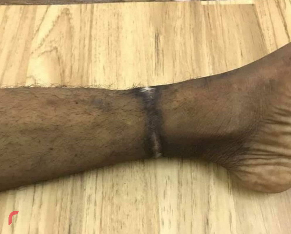 ނިޔާޒުގެ ފައިގައި ނިޝާންތަކެއް، އާއިލާގެ ތުޙުމަތުތައް މިނިސްޓްރީން ދޮގުކުރޭ