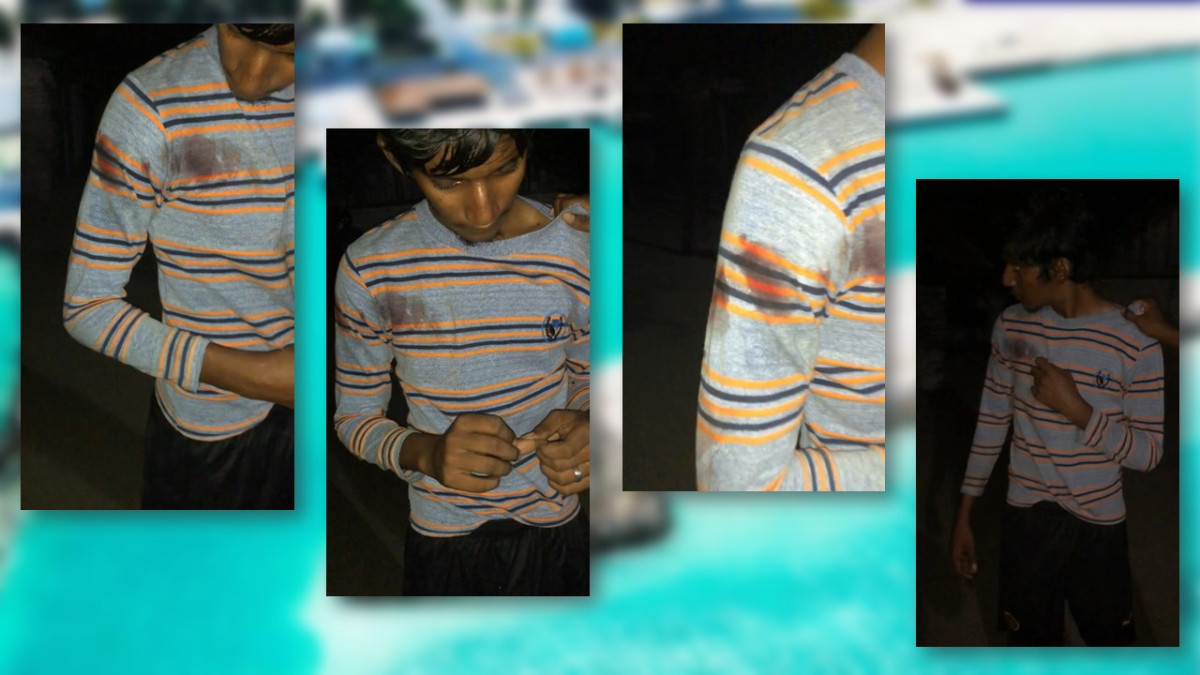 ހަނިމާދޫގައި އުމުރުން ދުވަސްވީ މީހަކަށް ހަމަލާދިން ޒުވާނާ