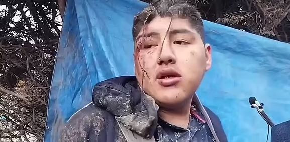 އަލްވަރޭޒް