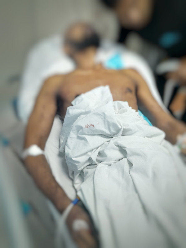 އަތުހަރު މަރުވުމުގެ ކުރިން، ހާލު ސިރިއަސްވެ، ވެންޓިލޭޓަރުގައި ފަރުދިނުން