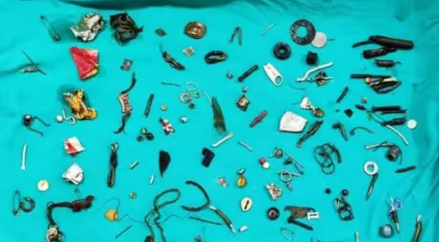 އެމީހާ ބަނޑުން ނަގާފައިވާ ތަކެތި