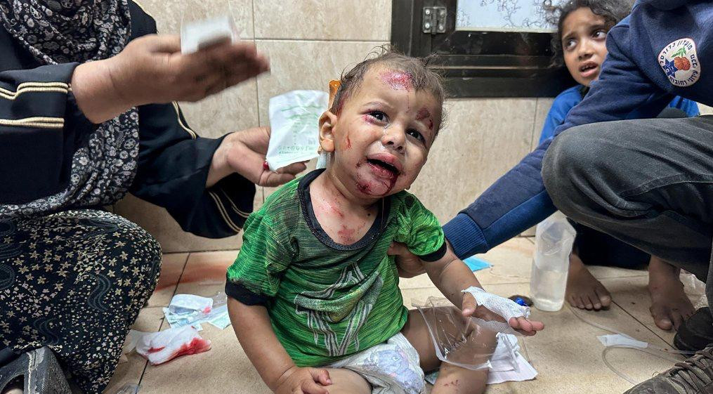 އިސްރާއީލުން ދިން ޙަމަލާއަކާ ގުޅިގެން ޒަޚަމްވި ކުޑަކުއްޖަކު (ފައިލް ފޮޓޯ)