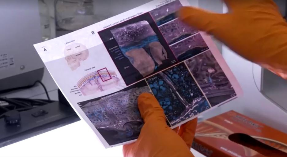 ހެއިމްހޯޓްޒް އިންސްޓިޓިއުޓްގެ އިންޤިލާބީ ހޯދުމަކީ، ސިކުނޑިއަށް ޖެހޭ އަލްޒައިމާޒްއާއި ސްޓްރޯކް ފަދަ ބަލިތައް ދެނެ ގަތުމަށް ބޭނުން ކުރެވިދާނެ ހޯދުމެއް