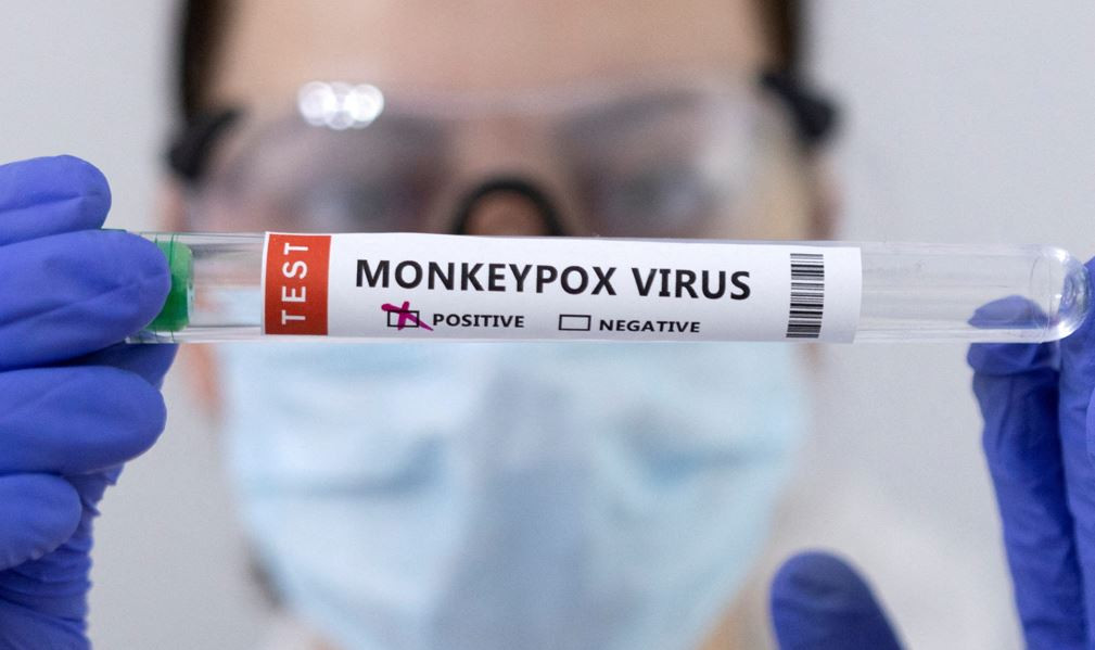 މަންކީޕޮކްސް އަށް ޓެސްޓުކުރުމުގެ މަރުހަލާގެ ތެރެއިން